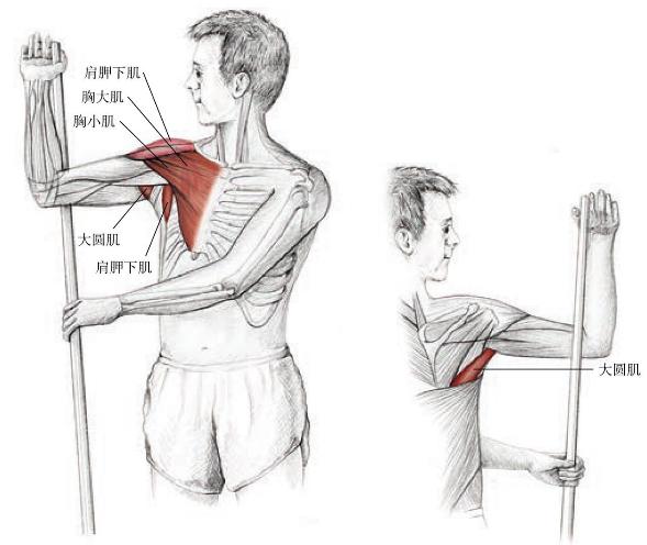网友打羽球得网球肘用很多方法不见好，送他这套运动康复方案