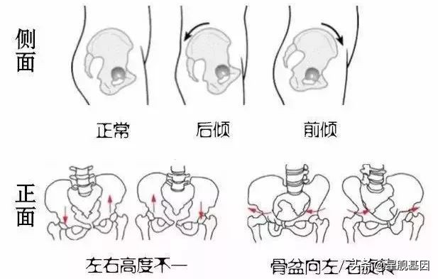 产后妈妈十大疼痛,哪一个你中招了?
