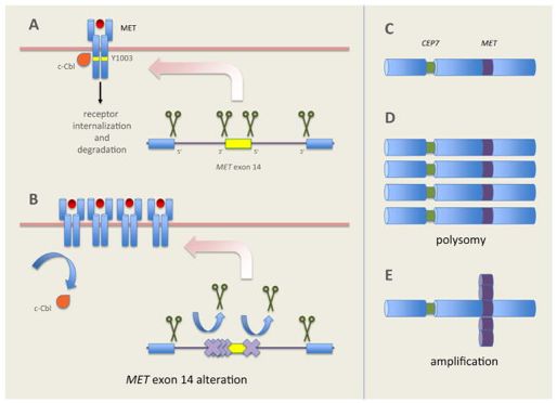 肺癌罕见突变,met14突变肺癌临床数据