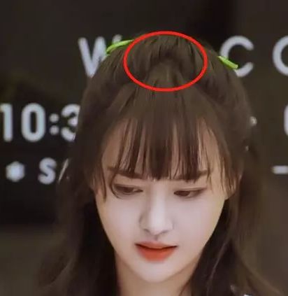 发际线秃有没有好的方法,发际线秃了一块怎么弄齐刘海