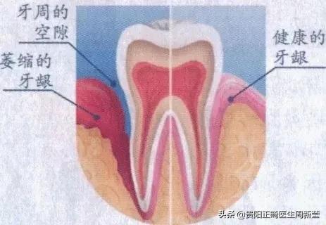 市面上冷光美牙仪真的有用吗,蓝光美白牙仪真的管用吗