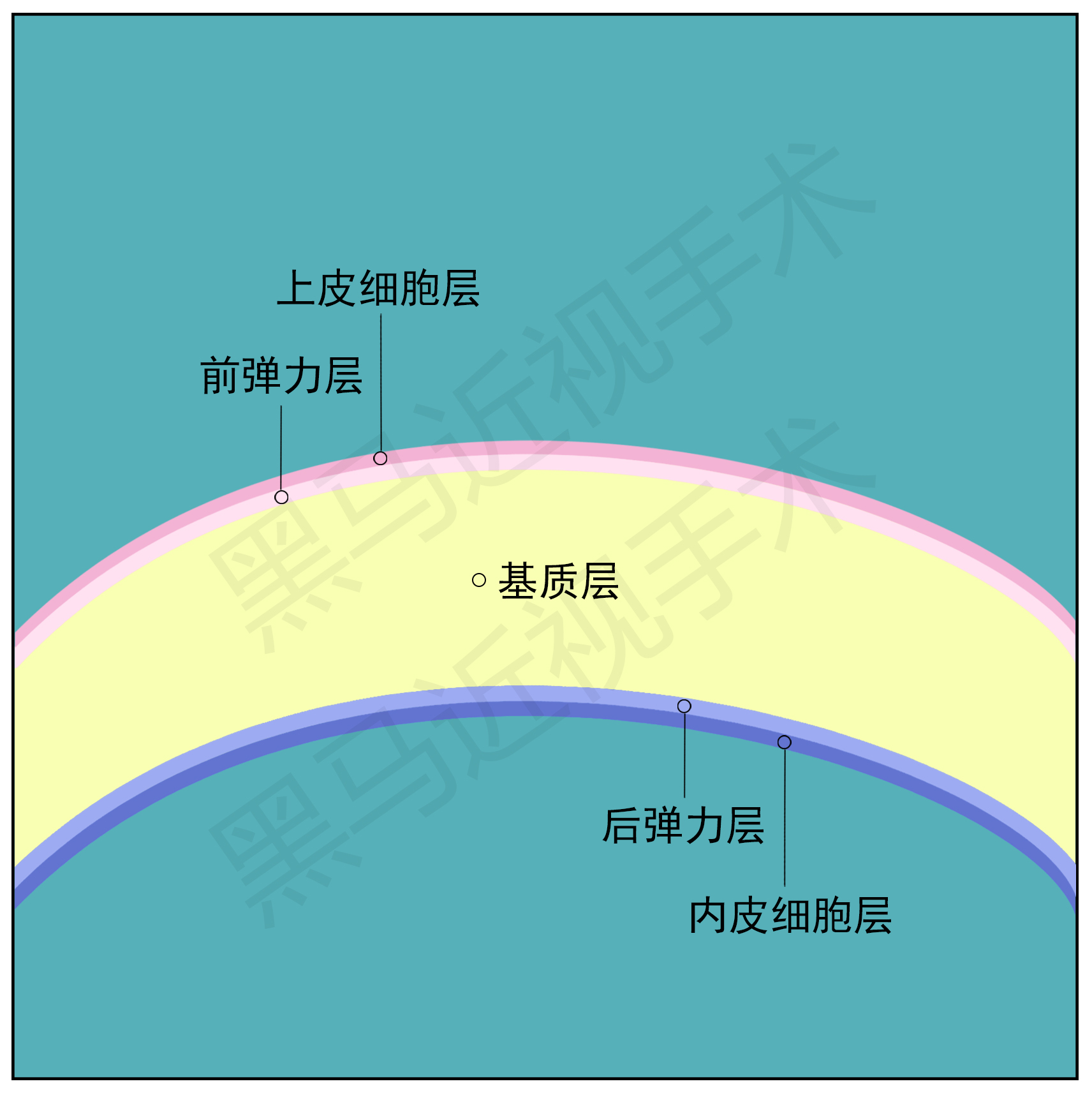 激光近视矫正手术有什么后遗症,激光治疗近视安全啊有没有后遗症