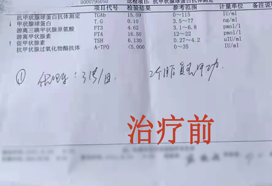 为什么甲亢治成了甲减？只怪当初选错了治疗方法？