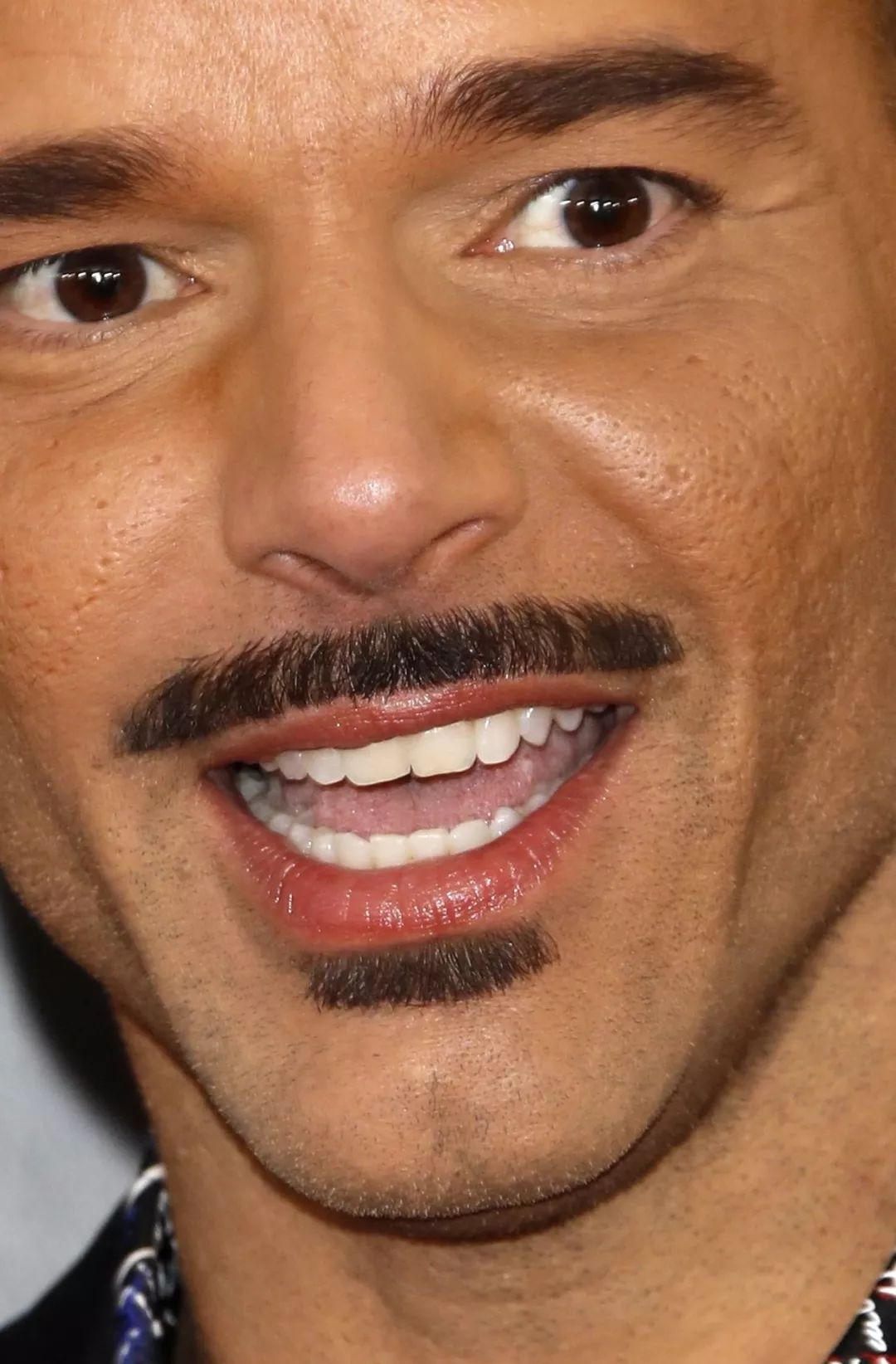 RickyMartin的粉丝希望他去做微针治疗改善皮肤