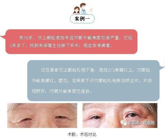 眼科病历视频,眼科病例分享全集