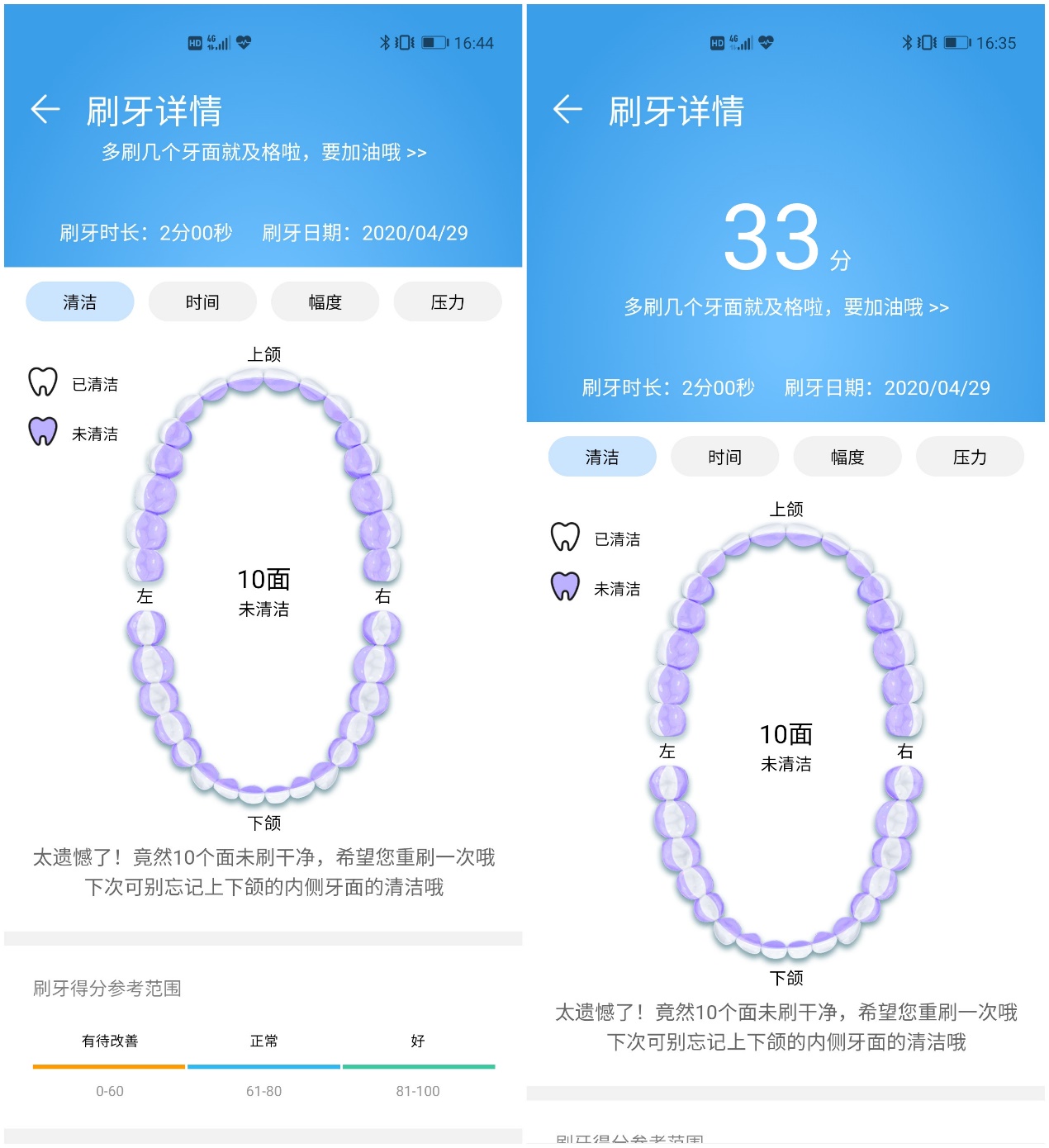你的刷牙够全面吗？华为HiLink力博得智能声波牙刷（星钻）体验！