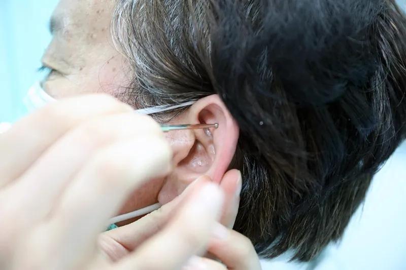 上海松江中医推荐,睡不着中医按哪个地方