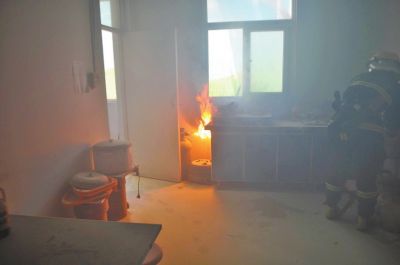 意外烫伤烧伤急救方法,意外烧伤恢复过程图解