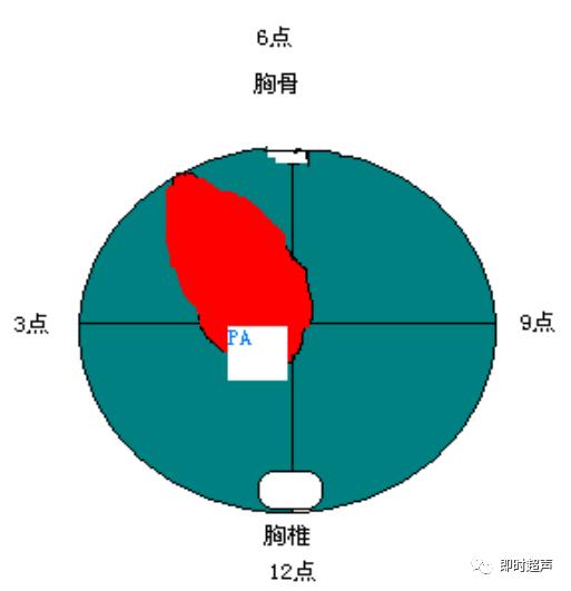 胎儿心脏三种血管关系模式图,25周的胎儿心脏弓切面多少正常