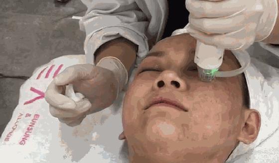 带你了解激光美容走出10个误区,激光美容的12个误区一定要记清