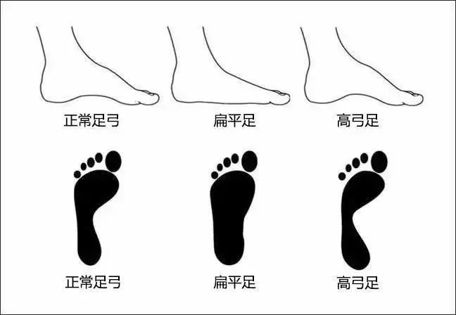 羽毛球鞋的选择与注意事项,如何挑选一款适合自己的羽毛球鞋