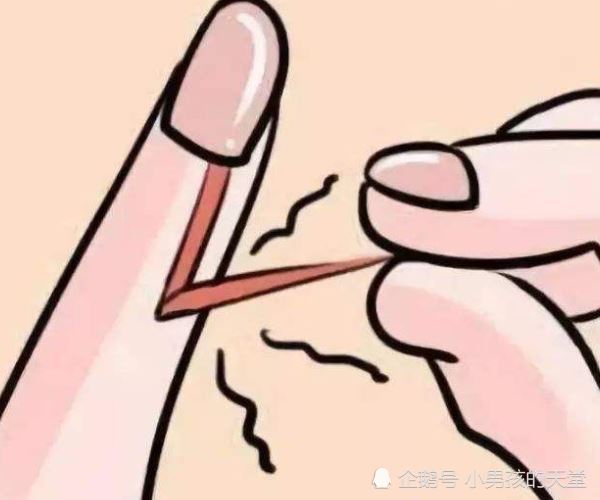 强迫症等级视频,强迫症在部队能评几级残