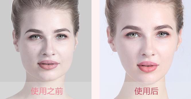 做美容的女人勇气可嘉,打了美容针的女人现在怎么样了