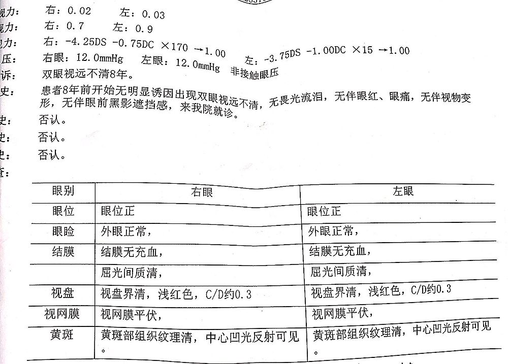 隐形眼镜有散光加近视,近视度数高有散光戴隐形眼镜