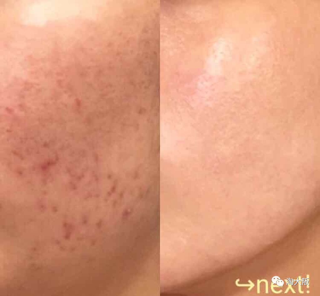 日本又刮起一阵蜜桃风！被夸爆的BCL乳酸菌又出神仙单品啦！