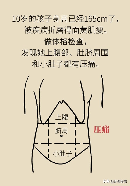 小女孩辣条吃多了肚子痛,吃辣条吃多了腹部绞痛