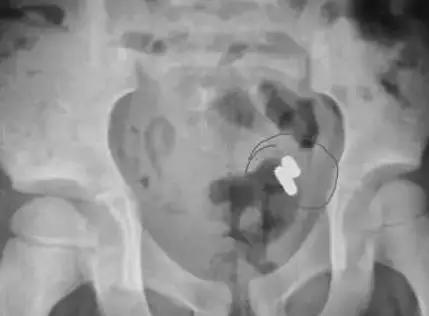 4岁男孩吃了它，体内充血水肿糜烂！快把家中这个东*藏西**好