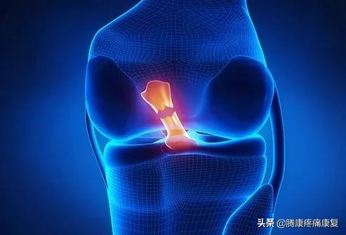 前交叉韧带断裂半月板后角撕裂,左膝前交叉韧带部分撕裂怎么办