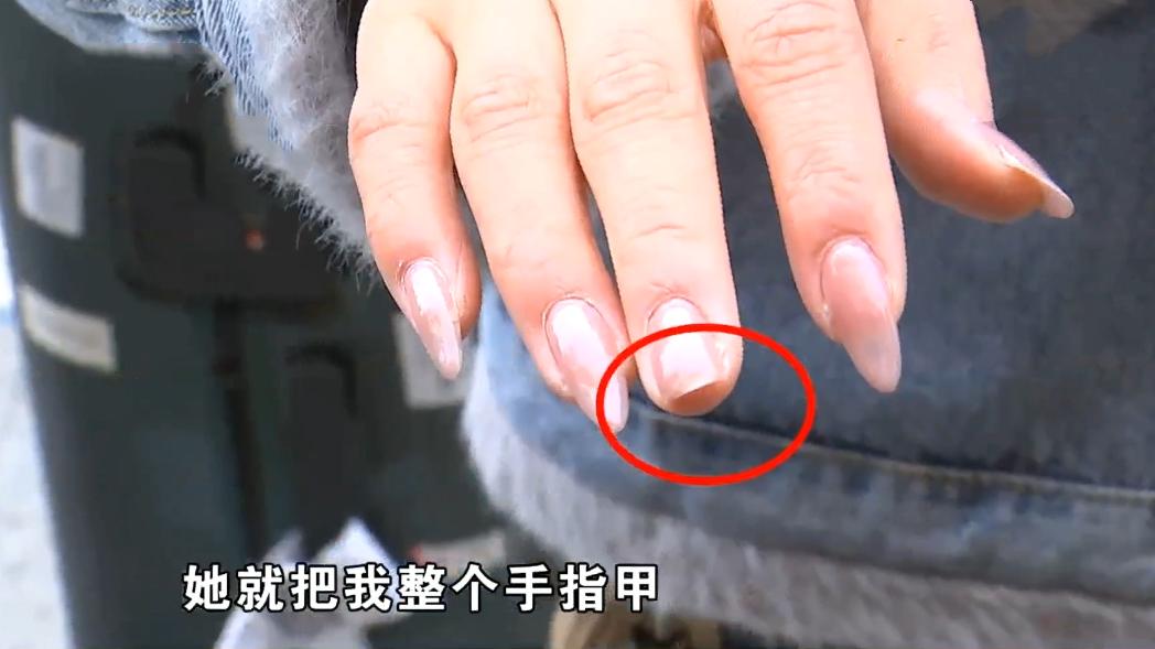 女子因4000元被泼开水事件,女子被开水烫后续