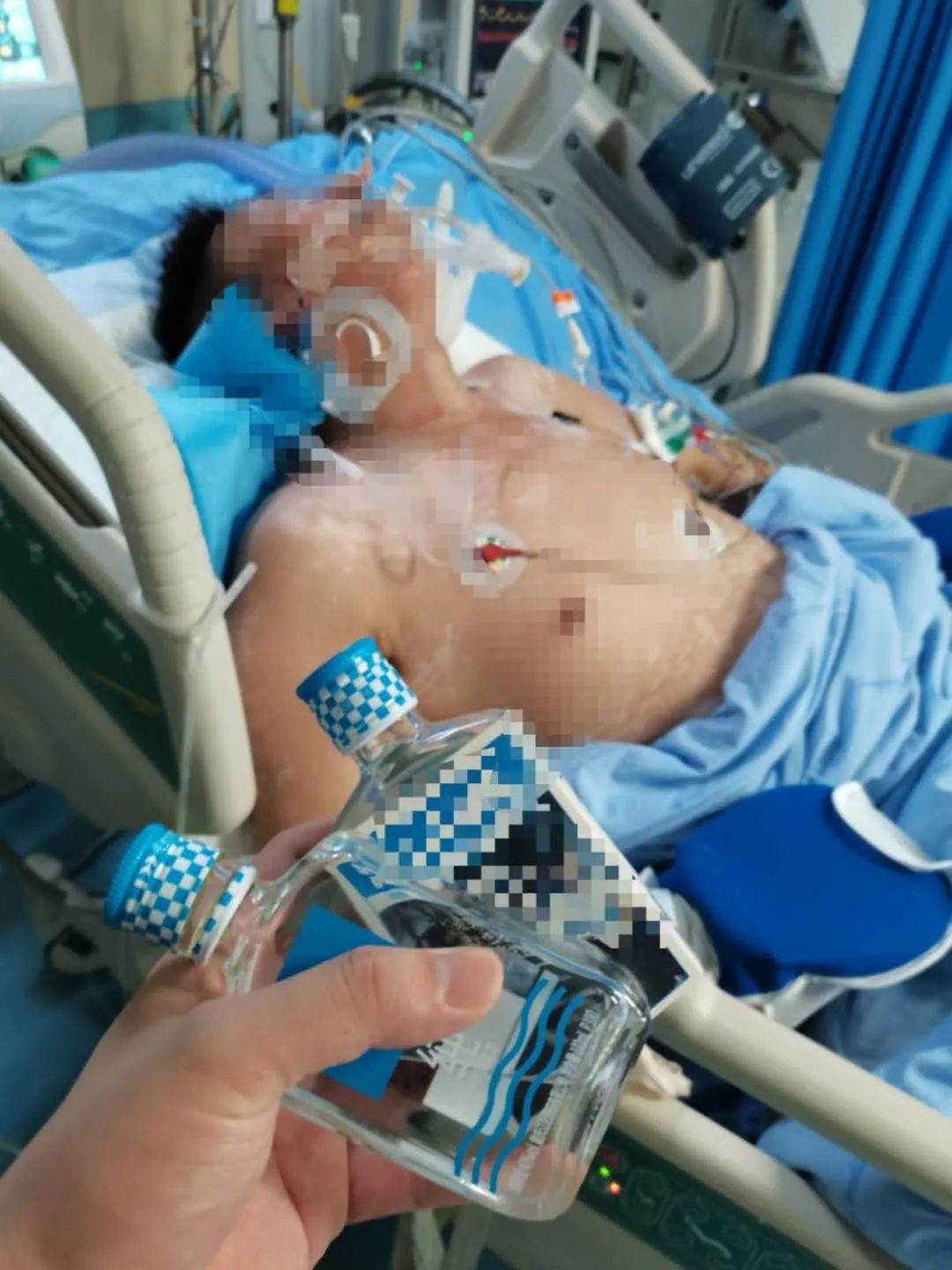 假酒喝了有什么症状怎么解毒,假酒中毒真的可以用真酒解毒吗