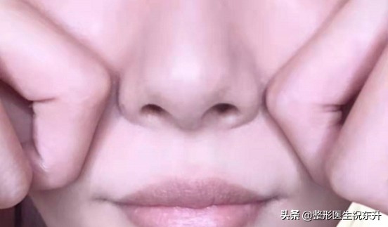 法令纹严重怎么办30岁,中年人怎么去除法令纹