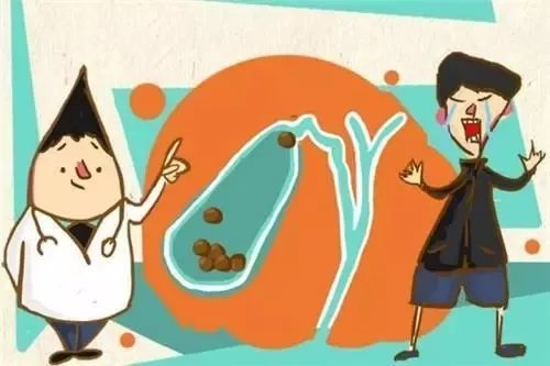 便宜的排石药和好的排石有区别,300元一盒的排石药