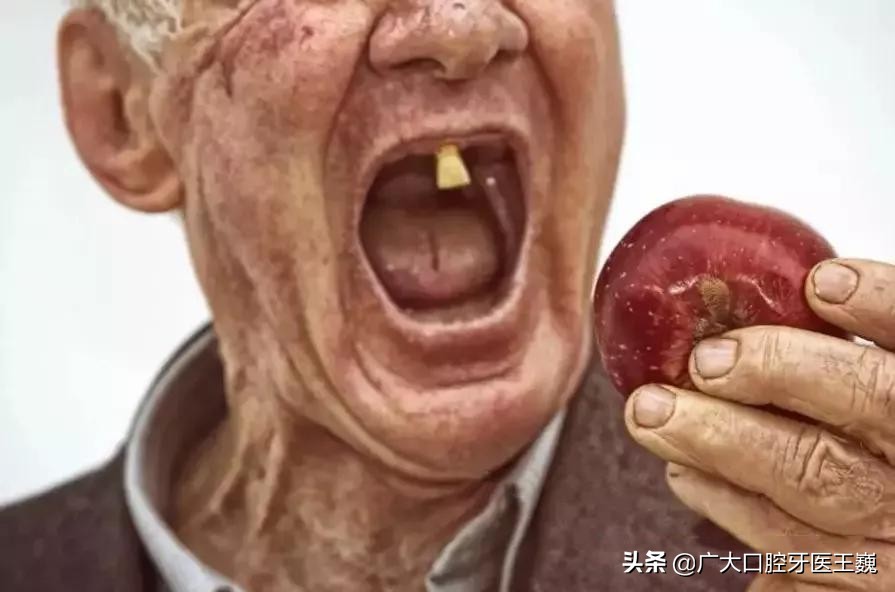 不镶牙的后果,拔牙不清创的后果