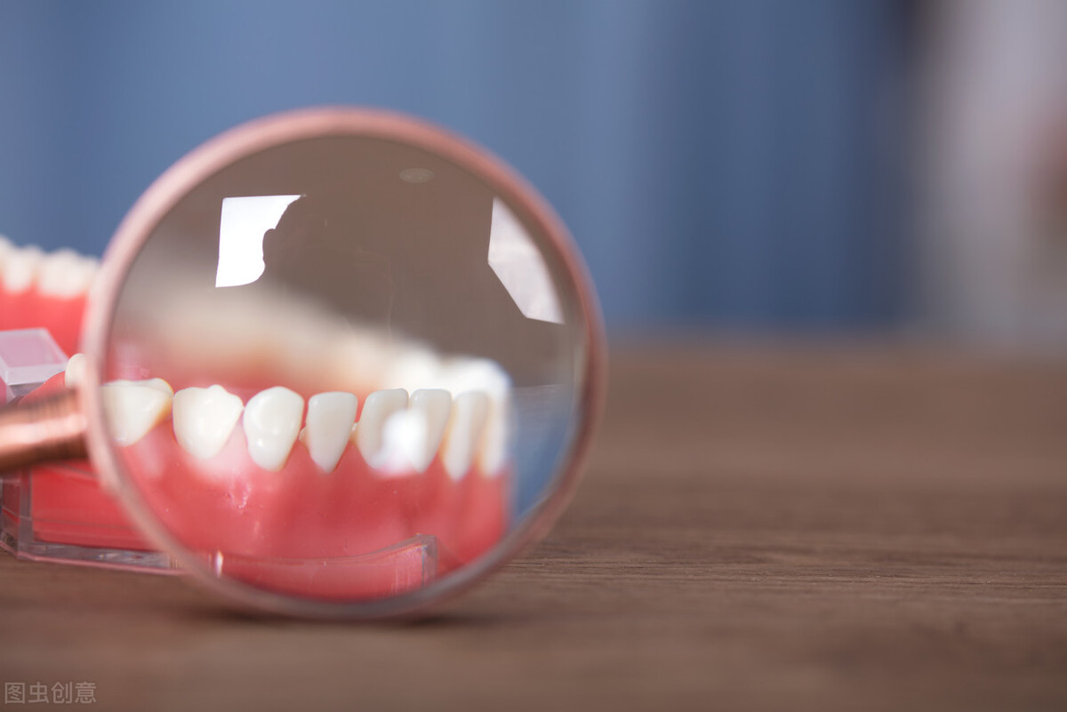 牙结石是每个人都会有的吗,牙结石是每个人都会有的嘛