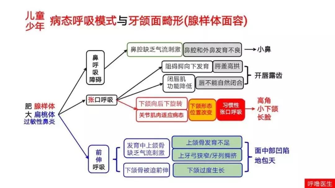 长期口呼吸的人是不是很没出息,长期口呼吸让人变丑