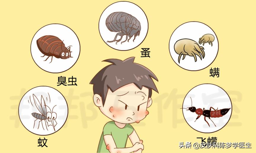 被蚊虫叮咬留下的“红包”怎么办？你可以选择这些药膏