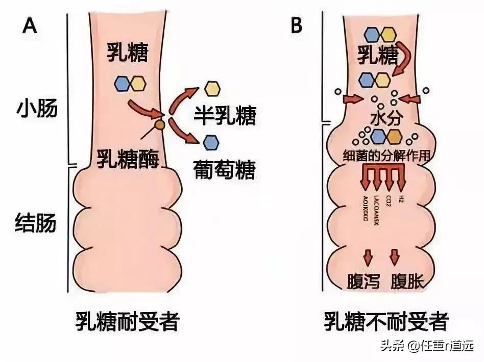 宝宝乳糖不耐受乳糖酶要一直吃吗,宝宝乳糖不耐如何补充乳糖酶