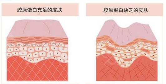毛孔粗大怎么办最有效收缩毛孔,毛孔粗大收缩毛孔最快有效的方法