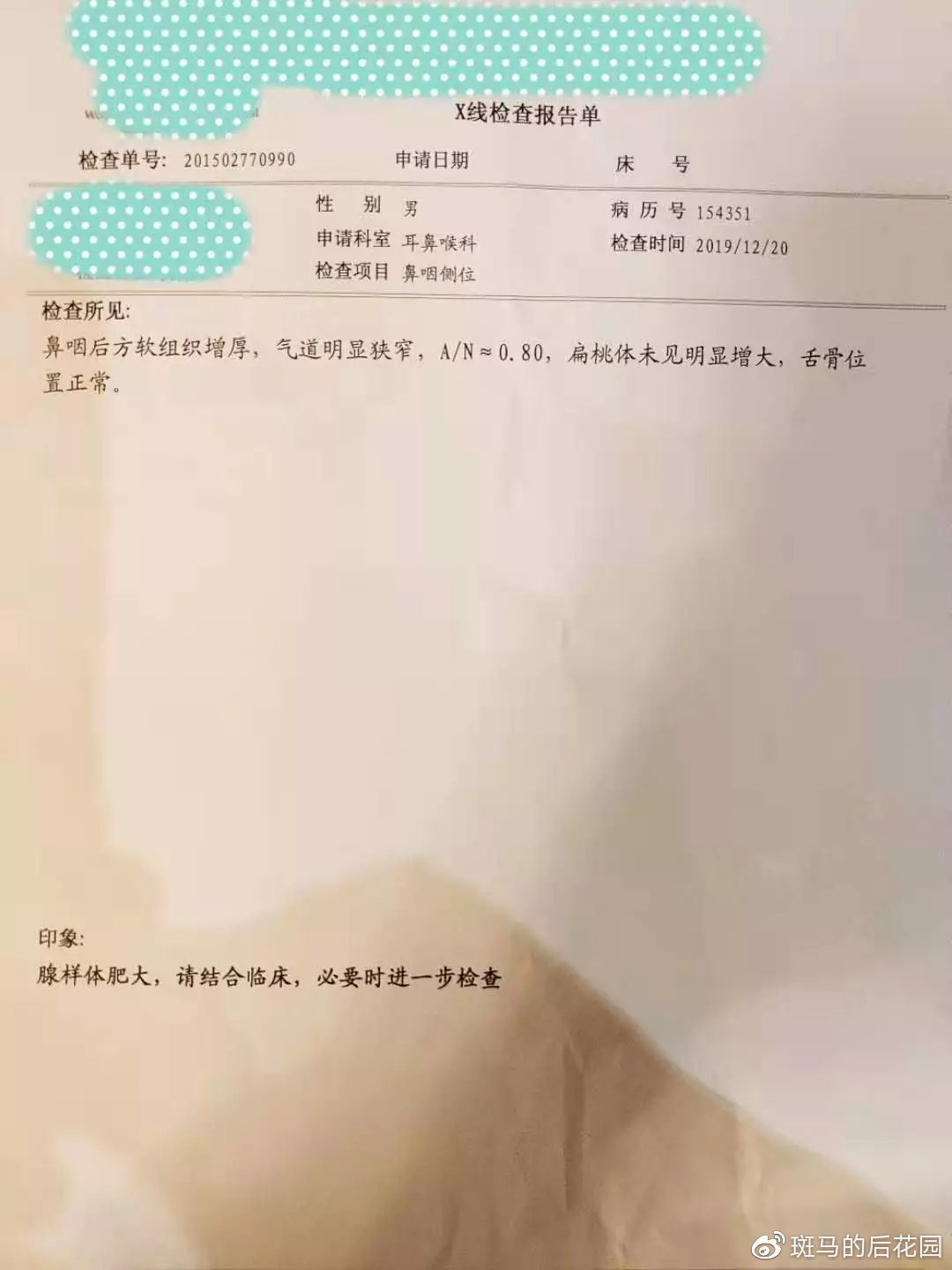 腺样体肥大对长大有什么影响,腺样体长大就萎缩害了多少孩子