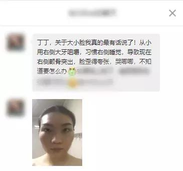 脸大小不对称怎么矫正,如何改善大小脸不对称