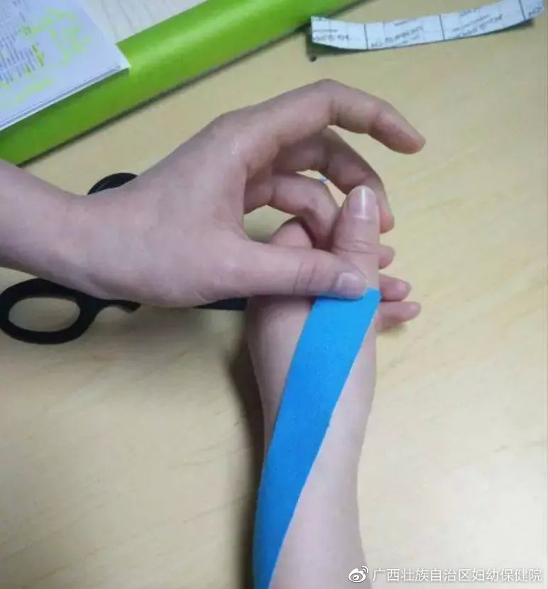 宝宝大拇指一直内扣怎么纠正过来,宝宝拇指内扣最严重的结果是什么