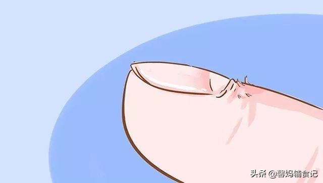 宝宝手上有倒刺应该怎么解决,宝宝手上长倒刺用什么药