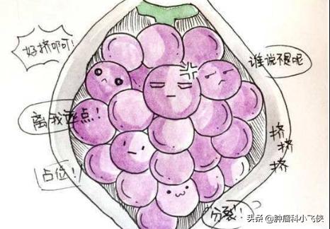 孕早期子宫异常增大伴阴道出血，医生提示小心葡萄胎可能