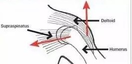 中医怎么看肩膀冈上肌疼痛,肩膀冈上肌疼痛