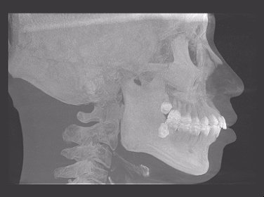 正畸医生杨磊,北大口腔医院修复科杨磊