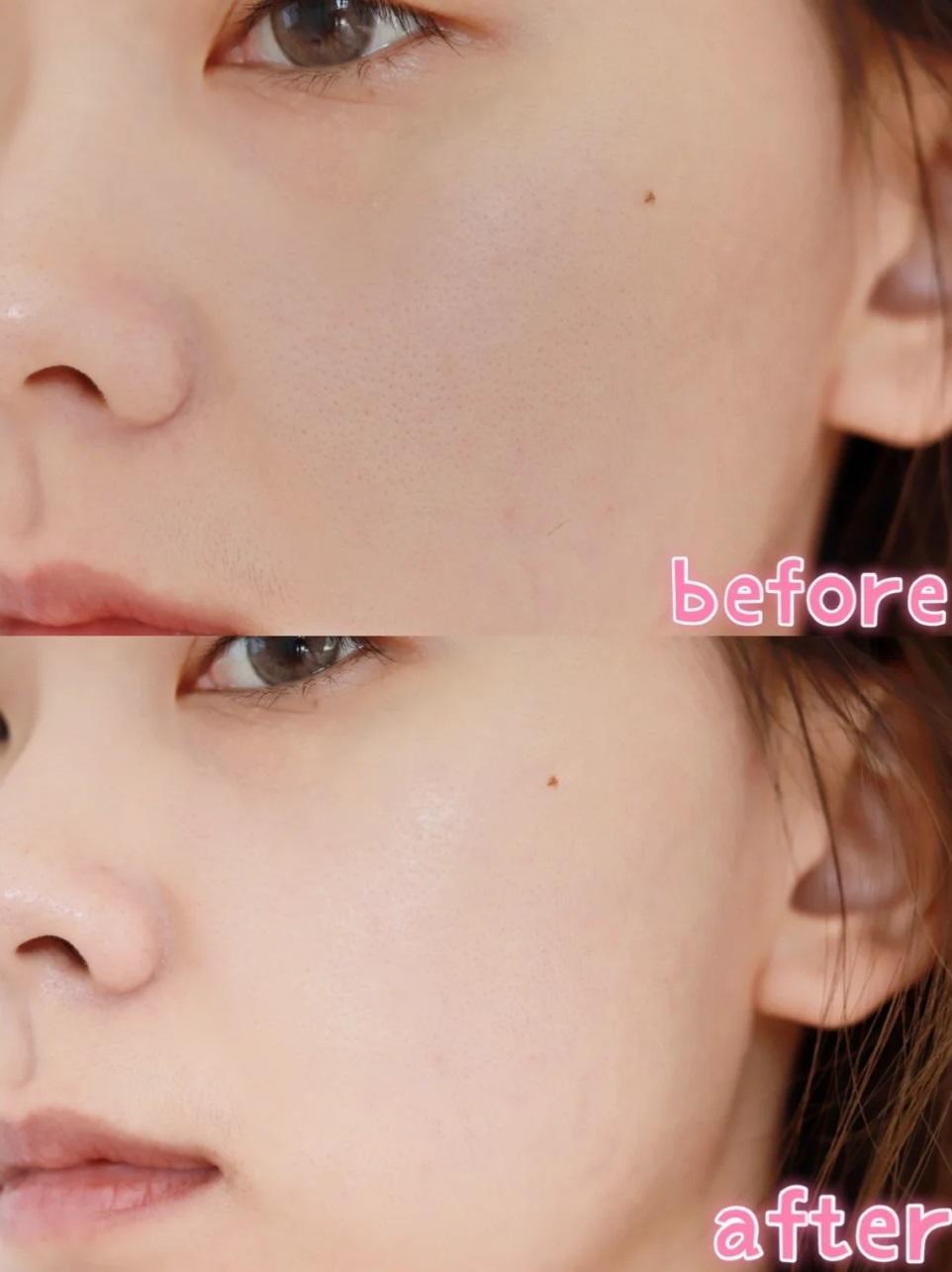 油性皮肤秋冬用兰蔻粉水还是蓝水,春季补水兰蔻粉水