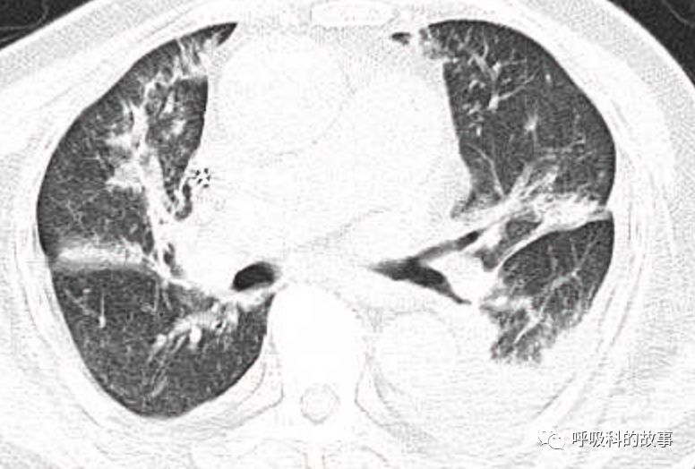 临床医学需要经历什么尴尬的事,解决两难问题