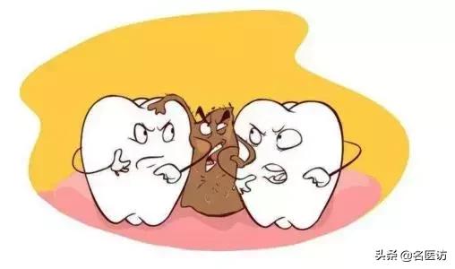 牙周炎才是牙齿松动的罪魁祸首,牙周炎导致全部牙齿脱落镶什么牙