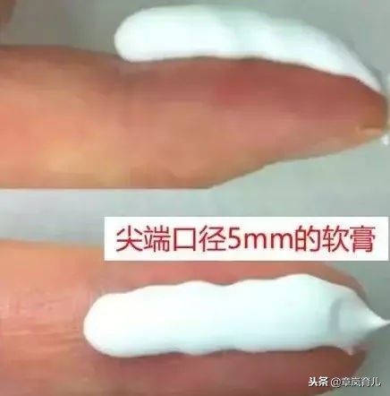 脸上湿疹涂了有激素的药膏怎么办,宝宝湿疹老是反复妈妈要忌口吗