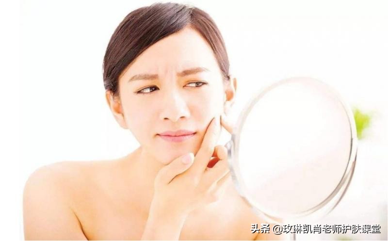 脸上闭合性粉刺如何去除最有效,闭口性粉刺是怎么回事