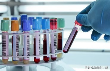 抽血大夫说我血稠,验血怎么感觉血的颜色黑呢