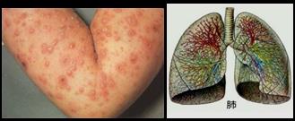 抗肿瘤药,直接影响DNA结构和功能的药物