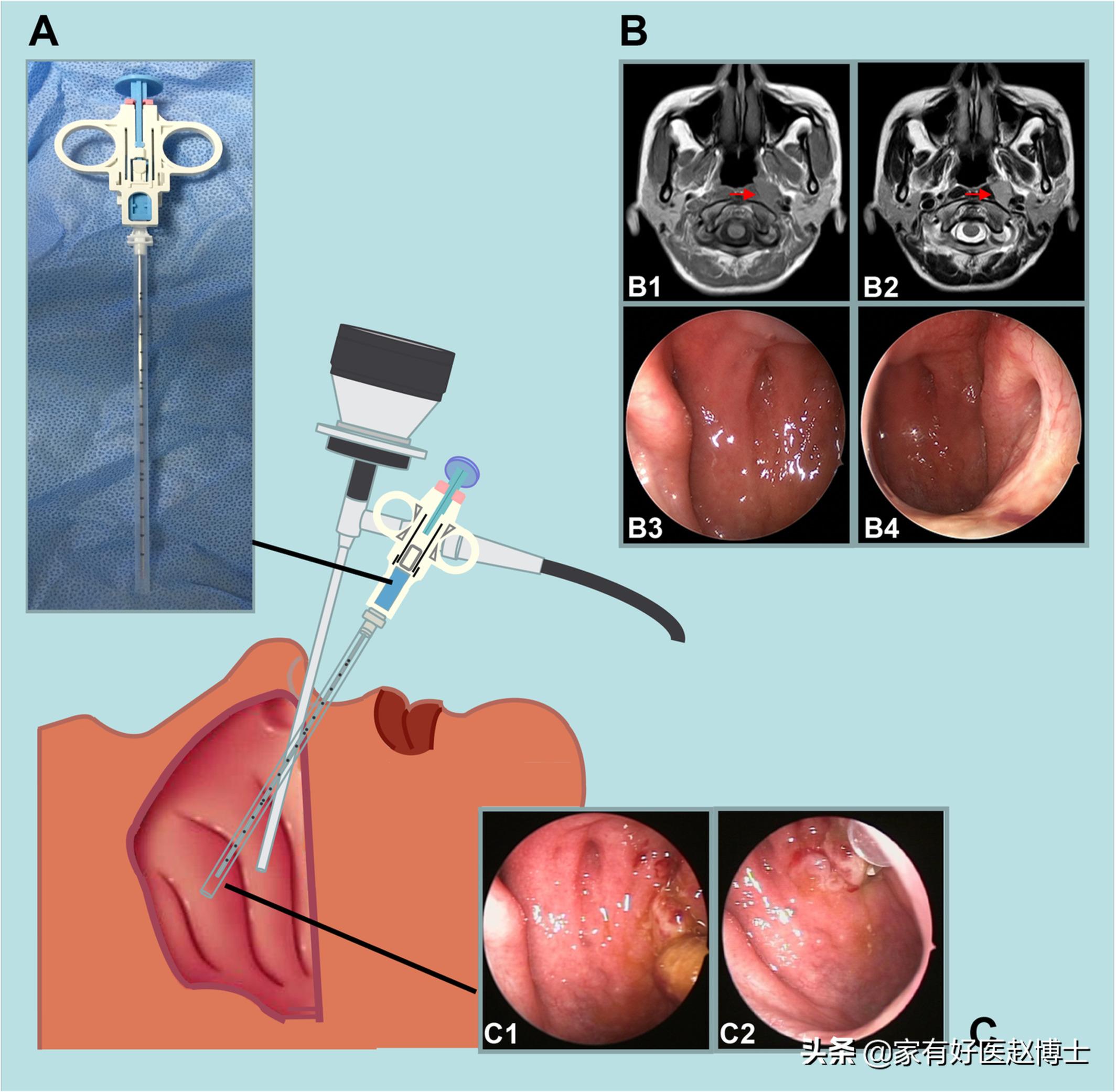 细菌、病毒、寄生虫也可致癌?防癌,务必远离7大常见致癌病原体