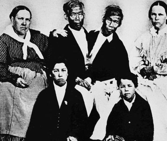 连体人是如何结婚生子呢,连体人结婚生了孩子是什么样子