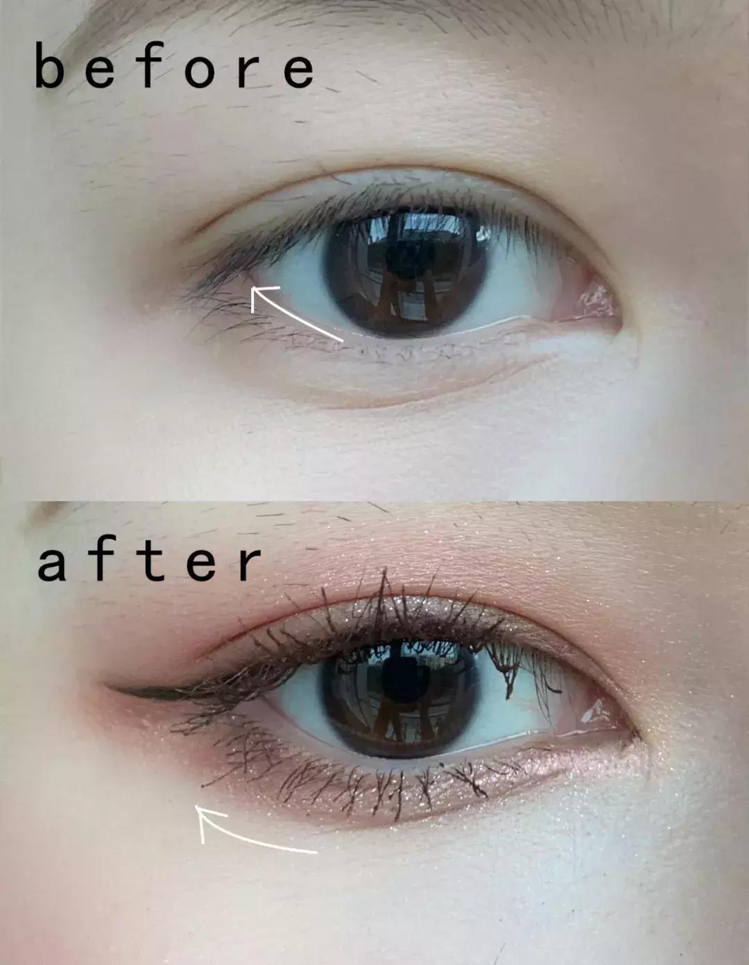 去割双眼皮,去韩国割双眼皮科学不