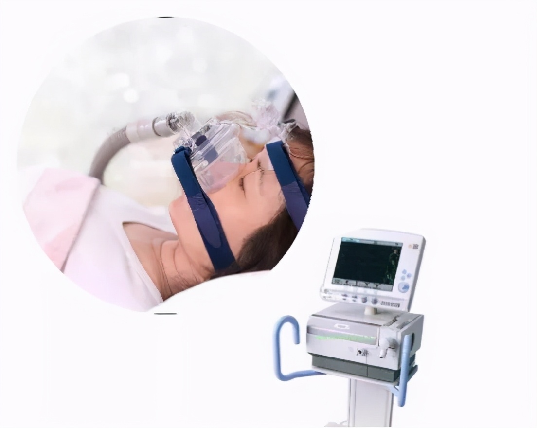 icu对患者实施必要的保护性治疗吗,icu生命支持系统